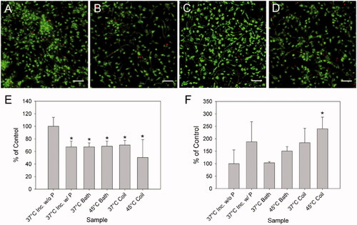 Figure 2. Viability assessment of primary cortical neurons exposed to heat generated by iron oxide nanoparticles in an alternating electromagnetic field or a water bath. Images of live neurons by calcein-AM (green) and dead nuclei by propidium iodide (red) 24 h after exposure to: control without nanoparticles (37 °C inc. w/o P) (A), and with nanoparticles (37 °C inc. w/P) stored in the incubator (B), heating to 45 °C by water bath immersion (45 °C bath) (C), and by magnetic stimulation (45 °C coil) for 2 h (D), both in the presence of nanoparticles. Quantification of the percentage area covered, of each image relative to the control for live neurons (E) and dead nuclei (F). For comparison, these graphs also show results for cells with nanoparticles heated to 37 °C for 2 h in a water bath (37 °C bath) and a magnetic field (37 °C coil). All samples with nanoparticles were significantly reduced in the percentage area covered as compared to the control, whereas only the 45 °C coil sample displayed a statistically significant increase in the number of dead nuclei (*p < 0.05 relative to control without particles). Error bars represent one standard deviation, n = 9 for all samples. All images are captured with a 20× objective lens. Scale bar represents 50 μm. For interpretation of the references to colour in this figure legend, the reader is referred to the web version of this article at www.informahealthcare.com.