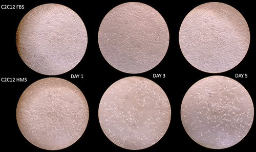 Figure 7. Comparative microscopy showing reduced cell adhesion over a five-day period, in C2C12 cells grown in human menstrual serum (HMS) versus those grown in fetal bovine serum (FBS) © WhiteFeather Hunter, Citation2022.