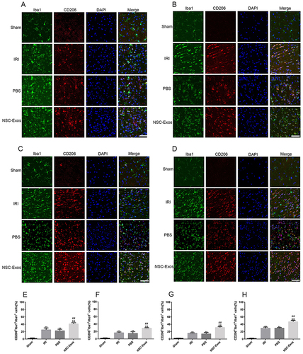 Figure 7 Representative images of parietal cortex co-stained with CD206 and Iba1. (A–D) Representative co-stained images of CD206 and Iba1 on 1d, 3d, 7d, and 14d, green fluorescence indicates Iba1, red fluorescence indicates CD206, and blue fluorescence indicates nuclei. There was almost no co-staining in the sham group, and the CD206+/Iba1+ cells increased after MCAO. After NSC-Exos treatment, CD206+/Iba1+ cells were significantly increased at 1d, 3d, 7d, and 14d, which promoted the expression of M2-state markers. (A) At 1d, a small amount of CD206 cells was expressed. (B) At 3d, the expression of CD206 began to increase. (C) At 7d, it continued to increase. (D) At 14d, CD206 was highly expressed. (E–H) The proportion of CD206+/Iba1+ in Iba1+ at 1d, 3d, 7d, and 14d in turn. CD206+/Iba1+ cells began to increase at 1d, and continued to increase at 3d, 7d, and 14d (**P<0.01 vs Sham group; ##P<0.01; &&P<0.01 vs PBS group, Scale bar=20μm).