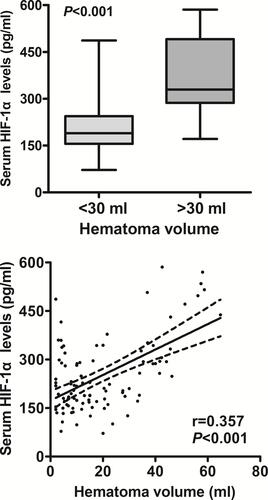 Figure 3 Relationship between serum hypoxia-inducible factor 1alpha levels and hematoma volume after intracerebral hemorrhage. When hematoma volume was a continuous variable, serum hypoxia-inducible factor 1alpha levels were significantly raised with rising hematoma volume using Spearman correlation coefficients (P<0.001). When hematoma volume was identified as a categorical variable and subsequently, patients were divided into two groups in accordance with hematoma volume, namely, above 30 mL and below 30 mL, patients with hematoma volume above 30 mL had substantially higher serum hypoxia-inducible factor 1alpha levels than those with hematoma volume below 30 mL using Mann–Whitney U-test (P<0.001). In correlation graph, the solid line means line of best fit and dashed line represents 95% confidence interval of a population mean.