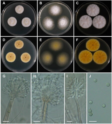 Figure 4. Morphology of Aspergillus baeticus CNUFC GRS15. (A, D) Colonies on Czapek yeast autolysate agar (CYA); (B, E) malt extract agar (MEA); (C, F) yeast extract sucrose agar (YES) (A–C: obverse view and D–F: reverse view); (G–I) Conidiophores; (J) Conidia. Scale bars = 10 µm.