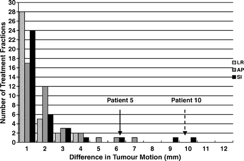 Figure 5.  The difference in tumour motion between planning and treatment for 12 patients treated using SBRT. The results are consistent with the exception of two patients indicated by arrows.