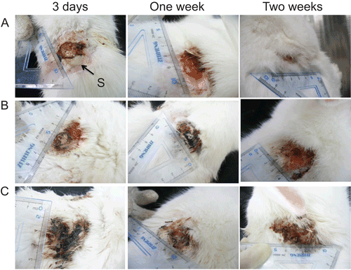 Figure 8.  Development of wound healing in MRSA infected New Zealand rabbits treated with (A) CCHL; (B) chitosan-collagen hydrogel; and (C) saline during 2 weeks. Solid arrow indicated suppuration (S).