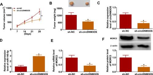 Figure 7 CircDNM3OS knockdown repressed the growth of CCA in mouse model. 10 BALB/c nude mice were subcutaneously injected with HuH28 cells carrying sh-circDNM3OS or sh-NC. (A) Tumor volume of the sh-circDNM3OS or sh-NC groups was estimated once a week. (B) Tumor weight of the sh-circDNM3OS or sh-NC groups was shown. (C–F) The levels of circDNM3OS, miR-145-5p, MORC2 mRNA, and MORC2 protein in xenograft tumors in the sh-circDNM3OS or sh-NC groups were assessed by qRT-PCR or Western blotting. *P < 0.05.