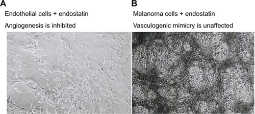 Figure 2 The therapeutic effects of endostatin (an angiogenesis inhibitor) on microvascular endothelial cells (A), lack of vessel networks) compared with melanoma cells (B), VM formation was unaffected) in three-dimensional gels of collagen I in vitro.Note: Reprinted by permission from Springer Nature, Nature Reviews Cancer, Vasculogenic mimicry and tumour-cell plasticity: lessons from melanoma, Hendrix MJ, Seftor EA, Hess AR, Seftor RE, COPYRIGHT 2003.Citation77