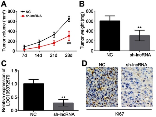 Figure 6 In vivo effect of LOC105372579 on HCC growth. (A) Tumor volumes were measured at described time points. (B) Tumor weight was determined 4 weeks post injection. (C) Relative expression of LOC105372579 in tumor tissues of xenograft assay. (D) Ki67 expression was measured by IHC in tumor tissues of xenograft assay. **P<0.01. Magnification ×200. Abbreviation: HCC, hepatocellular carcinoma.