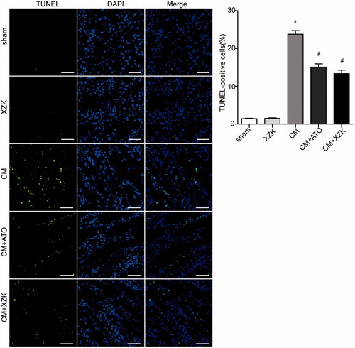 Figure 3. TUNEL staining in study groups. TUNEL-positive cells were stained brightly green. Scale bar, 100 μm. *p < 0.01 versus group sham and group XZK; #p < 0.01 versus group CM. n = 10. Values are mean ± SEM.