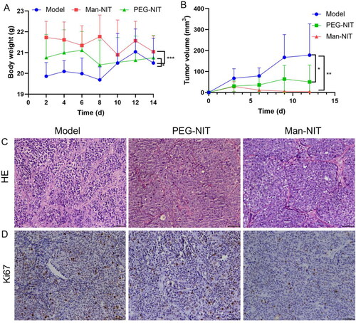 Figure 7. Tumor size and pathological characteristics after nanomicelles treatment for nude mice. (A) Body weight (g); (B) Tumor volume (mm3); (C) HE staining of tumor tissues (400×); (D) Immunohistochemical detection of Ki67 protein in tumor tissues, scale bars: 400×.