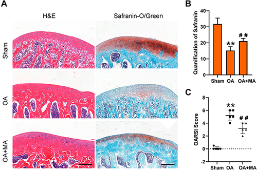 Figure 5 MA attenuates OA progression in rats. (A) HE and Safranin-O/green staining of the car-tilage of sham, OA and OA+MA groups. (B) Safranin-O quantification and (C) the OASRI score of the sham and the experimental groups. The data are presented as mean ± SD. Significant differ-ences are represented as ** p < 0.01 compared with the sham group, ##p < 0.01 compared with the OA group, n = 5.