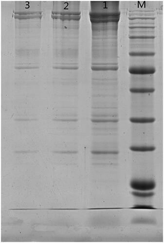 Figure 1. Comparison of extraction effect of different lysis buffers on erythrocyte membrane in sodium salt (sds)-polyacrylamide gel electrophoresis (SDS-PAGE). M. Standard protein maker 1. Octylphenoxypolyethoxyethanol (NP-40) lysis buffer 2. Radio immunoprecipitation assay (RIPA) lysis buffer (medium) 3. RIPA lysis buffer (weak).