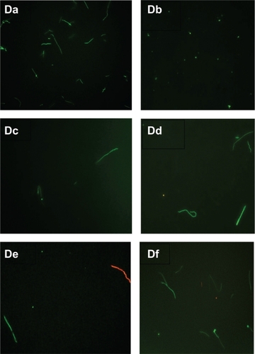 Figure 3D Evaluation of live/dead spirochete and round body forms of B. burgdorferi following treatment with five antibiotics measured by fluorescent microscopy using SYTO®9 green-fluorescent stain (live organisms) and propidium iodide red-fluorescent stain (dead organisms). Visualization of spirochete and round body forms of strain S297 following antibiotic treatment measured by dark field microscopy: (Da) Control; (Db) Doxycycline; (Dc) Tinidazole; (Dd) Metronidazole; (De) Tigecycline; (Df) Amoxicillin.Note: All images taken at 40× magnification.