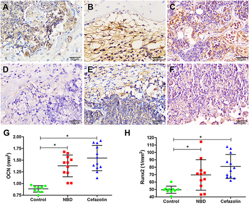 Figure 8 Immunohistochemical staining of Ocn and Runx2 of tibia defects at 4 weeks postoperation. Ocn expression in tissue sections of defect areas in control (A), NBD (B), and cefazolin (C) groups, and Runx2 expression in tissue sections of defect areas in control (n=10) (D), NBD (n=11) (E), and cefazolin (n=12) (F) groups. Quantitative analysis demonstrated strong positive staining of Ocn (G) and Runx2 (H) of the defect areas in the NBD and cefazolin groups, in contrast to the control group. *p<0.05. Ocn, osteocalcin. All samples of animals were examined.