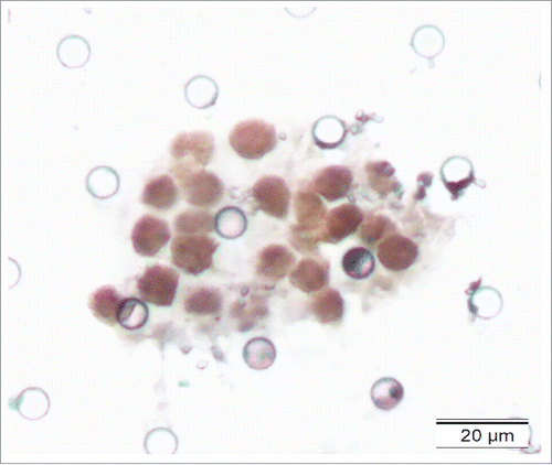 Figure 4. EBERs staining by ISH.