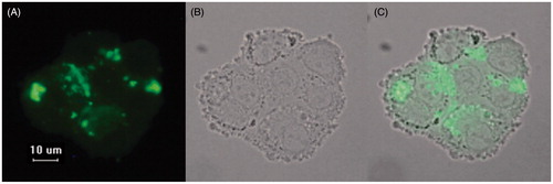 Figure 4. Uptake of FITC-labeled RPT–heLDL by U937 macrophages imaged at ×600 magnification. (A) Fluorescence image of FITC-labeled RPT–heLDL. (B) Corresponding bright field image of U937 macrophage. (C) Merged images of A and B.