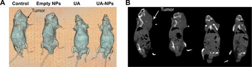 Figure 7 Corresponding CT images of mice post treatment were collected to estimate the therapeutic efficacy.Notes: (A) Volume rendered three-dimensional reconstruction and (B) transversal sections of mice posttreatment, via different methods.Abbreviations: CT, computed tomography; NP, nanoparticle; UA, ursolic acid; UA-NPs, UA-loaded poly(N-vinylpyrrolidone)-block-poly (ε-caprolactone) nanoparticles.