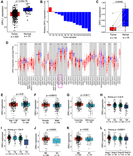 Figure 1 CRYL1 expression is significantly lower in ccRCC tissue samples than in normal tissue samples. (A) Differential expression of CRYL1 in the TCGA cohort. (B) CRYL1 expression was downregulated in 12 of 14 ccRCC samples. (C) CRYL1 levels were significantly lower in ccRCC tissue samples in 12 of the 14 paired tissue samples. (D) CRYL1 expression levels in the pan-cancer dataset on the TIMER database (https://cistrome.shinyapps.io/timer/). (E) No significant differences in CRYL1 expression levels in ccRCC tissue samples between young and old patients. (F–L) CRYL1 expression levels are significantly different in patients with different genders, tumor status, pathological grades, tumor sizes, presence/absence of lymph node metastasis, presence/absence of metastasis, and tumor stage.