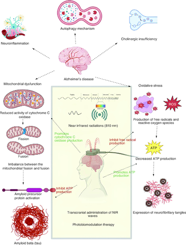 Figure 1. Photobiomodulation approach in the pharmacotherapy of Alzheimer's disease.The major pathophysiological mechanisms of AD involving the deposition of beta amyloid plaques and formation of neurofibrillary tangles, along with the role of photobiomodulatory therapy, are explained in the following figure.