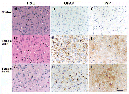 Figure 2 Neuropathology of brain sections from Tg(OvPrP) mice inoculated with saliva from scrapie-sick sheep (G–I) or with brain homogenate from scrapie-sick sheep that had been inoculated with SSBP/1 prions (D–F). Brain sections from uninoculated, 612-d-old, control Tg(OvPrP) mice are shown as controls (A–C). Sections show vacuolation (left column), astrocytic gliosis (middle column) and PrPSc deposition (right column). Tg(OvPrP) mice inoculated with saliva samples showed vacuolation (G), severe gliosis (H) and PrPSc deposits (I), similar to Tg(OvPrP) mice inoculated with scrapie-infected, sheep brain homogenate (D–F). Control mice showed no vacuolation (A), no gliosis (B) and no PrPSc deposits (C). Bar in I represents 50 µm and applies to all parts.