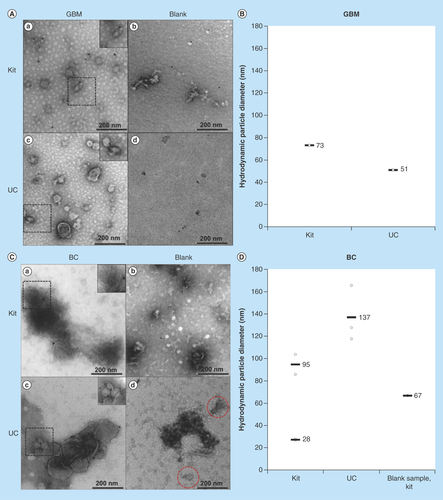 Figure 1.  Transmission electron micrographs and hydrodynamic particle size (nm) distribution by dynamic light scattering analysis of exosomes isolated by kit and ultracentrifugation from glioblastoma multiforme and  breast cancer cells.Images were taken with a magnification of 400,000 and the dashed areas were additionally zoomed. (A) Micrographs of GBM exosome isolates (not CD9-labeled). (a) depicts the micrograph from a kit isolate; (b) the kit blank; (c) a UC isolate; and (d) the UC blank. (B) DLS analysis of GBM exosomes isolated by kit and UC. No particles were detected in the UC blank. The DLS analysis of the kit blank was not performed. C) Micrographs of BC exosome isolates (successfully CD9-labeled). (a) depicts the micrograph from a kit isolate; (b) the kit blank; (c) a UC isolate; and (d) the UC blank. (D) DLS analysis of BC exosomes isolated by kit and UC, including the kit blank. No particles were detected in the UC blank.BC: Breast cancer; DLS: Dynamic light scattering; GBM: Glioblastoma multiforme; UC: Ultracentrifugation.