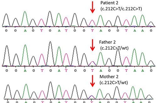 Figure 2 Sanger sequencing for validation of the variations detected by the next-generation sequencing platforms. POU1F1 c.212C>T variant in family members of Individual 2.