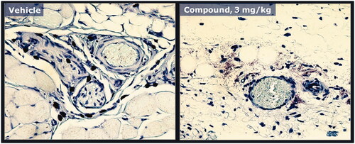 Figure 4. Mast cell degranulation caused by a peptide analogue that induces swelling/edema. Rat skin specimens shown in Figure 3 were processed and stained with tolui-dine blue and nucleus counterstain to confirm degranulation of mast cells in rats dosed subcuta-neously with either vehicle (left panel) or the peptide analogue (right panel). Example of a mast cell with histamine containing granules (red/dark stain) contained within the cytoplasm (left panel). Injection of the peptide analogue induced degranulation and extracellular dispersion of histamine containing granule contents (right panel).