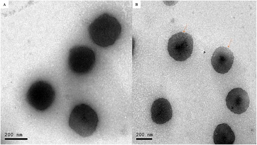 Figure 3. Transmission electron micrographs of INV14.INVs: Invasomes.