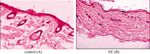 Figure 6. Histological findings of skin biopsies control (A), treated with NE (B).
