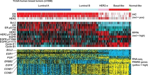 Figure 1 Proteomic and transcriptomic patterns associated with the intrinsic molecular subtypes of human breast cancer.
