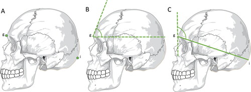 Figure 1. Metric analyses with statistical significance in sex estimation — skull. (A) Craniometric points — glabellae (g) and inion (i). (B) Glabellae inclination angle — a line is drawn from the glabellae parallel to the Frankfurt plane and another line tangential to the frontal bone. The resulting angle is smaller in men than in women. (C) Schwalbe’s frontal angle — a horizontal line is drawn connecting the glabellae to the inion and a vertical line tangential to the most prominent point of the frontal bone in the median sagittal plane.