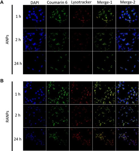 Figure 4 Representative confocal images of B16F10 cells incubated with coumarin 6-loaded nanoparticles (ANPs/C6 (A) and RANPs/C6 (B)) and LysoTracker Red for 1 hr, 2 hrs, and 24 hrs. Scale bar represents 20 µm.