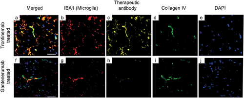 Figure 4. Triplex immunofluorescence of cynomolgus cortex brain sections 24 hours after a single IV injection of trontinemab (top) or gantenerumab (bottom). Immunofluorescent images showing the localization of microglia (IBA1, red), therapeutic antibody (anti-idiotypic) (yellow), vascular basement membrane (collagen IV, green) and nuclei (DAPI, blue) staining in brain sections 24 hours after trontinemab or gantenerumab dosing. At 24 hours post-dose, gantenerumab is limited to vasculature (co-localization with collagen IV), whereas trontinemab is present in the parenchyma (IBA1 co-localization) in addition to vasculature. Immunostaining was performed using the Ventana Discovery Ultra automated stainer. DAPI, 4′,6-diamidino-2-phenylindole; IBA1, ionized calcium-binding adaptor protein.
