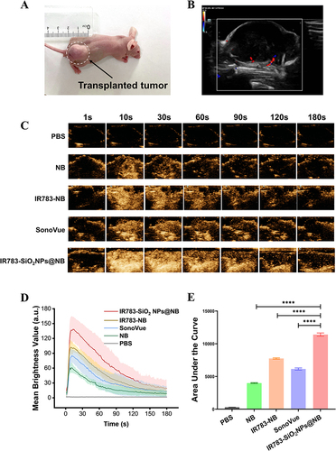 Figure 6 Evaluation of the CEUS imaging capacity of IR783-SiO2NPs@NB in vivo.