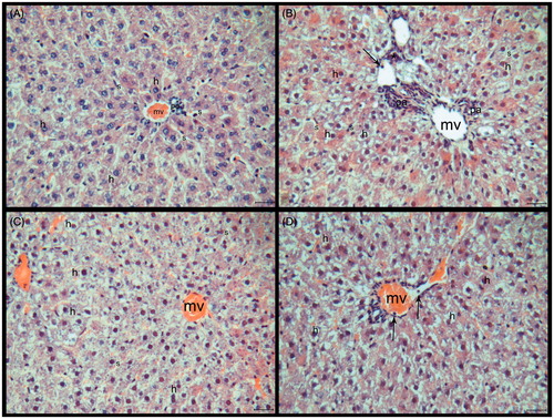 Figure 2. (A–D) Histological sections of the liver tissue of the experimental groups. (A) Control, (B) HED group, (C) HED + PLE group, and (D) PLE group. Central veins (mv), sinusoids (s), hepatocytes (h), leukocytes (→), inflammation areas (*), and portal areas (pa). HE, scale bar: 20 μm.
