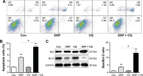 Figure 4 CQ promotes DDP efficacy in inducing SW13 cell apoptosis.