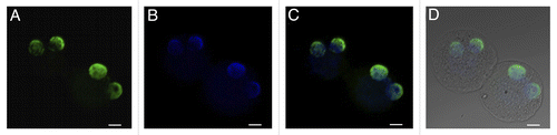 Figure 9. Distribution of H4K12ac in parthenogenetically activated oocytes. Maternal pronuclei after parthenogenetic activation display identical strong positive signal. H4K12ac (A), DAPI staining (B); H4K12ac with DAPI (C); H4K12ac, DAPI and DIC (D). Scale bars represent 20 µm.
