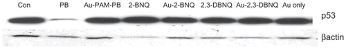 Figure 6 Western blot analysis of p53 protein expression showed that only plumbagin-treated cells had reduced expression of p53 at 100 nM concentration.