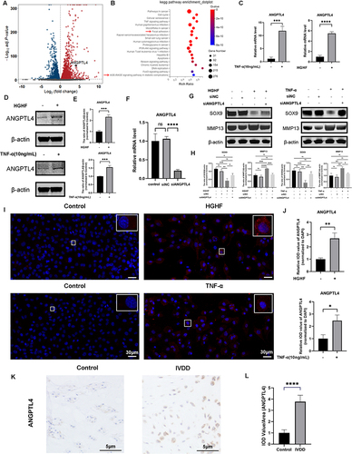 Figure 11 Experimental validation of ANGPTL4 under T2DM and IVDD. (A) Volcano plot of the expression level of NP cells stimulated by TNF-α via RNA sequencing. (Threshold as following, |fold change| ≥ 0, normalized to control, Q-value <0.001) (B) KEGG enrichment analysis based on the expression level of genes via RNA sequencing. (C–E) Quantification of ANGPTL4 in the RNA and protein level by RT-qPCR and Western blotting stimulated by HGHF and TNF-α. (F) Quantification of the efficacy of siANGPTL4 assessed by RT-qPCR. (G and H) Quantification of ECM degradation-related genes assessed by Western blotting treated by siANGPTL4 under the stimulation of TNF-α and HGHF in vitro. (I and J) Representative images and quantification of ANGPTL4 detected by immunofluorescence stimulated by HGHF and TNF-α. (K and L) Representative images and quantification of ANGPTL4 by immunohistochemistry in puncture-induced rat IVDD model, n=6. All data are presented as mean ± SD. *P < 0.05, **P < 0.01, ***P<0.001 and ****P<0.0001, n = 3. Arrows represent signaling pathways related to ECM degradation and T2DM in IVDD; T2DM, type 2 diabetes mellitus.