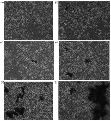 Figure 3. Changes of HELF cells morphology after exposure to SWCNTs-COOH. Concentrations of SWCNTs-COOH: (a) 0 µg/mL, (b) 1.25 µg/mL, (c) 2.5 µg/mL, (d) 10.0 µg/mL, (e) 30.0 µg/mL, (f) 50.0 µg/mL.
