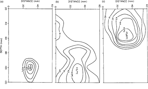 Figure 6. The isotherms measured in dog thigh using the four large focused transducers (FOC 5–8). (a) Stationary transducers focused at 100 mm depth. Total acoustic power was 7 W. The baseline temperature was 38–39°C. (b) A single 20 mm octagonal scan at a focal depth of 100 mm and centred at the 30 mm distance position. Total acoustic power was 27 W. The baseline temperature was 38–39°C. (c) A single 20 mm octagonal scan at a focal depth of 50 mm and centred at the 30 mm distance position. Total acoustic power was 22 W. The baseline temperature was 38–39°C.
