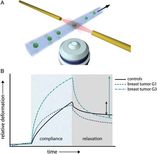 Figure 49. Cell biomechanics could be very useful for cancer diagnosis, e.g. using the optical stretcher, illustrated in (A). Average deformation and relaxation curves of benign cells and breast tumor cells from early and late stage tumors (G1 and G3) are shown in (B). With increasing tumor aggressiveness, the cells become more compliant. Despite the higher deformability, i.e. weaker elastic strength, late stage tumor cells show a stronger relaxation behavior. This relaxation behavior of softer tumor cells can only be explained by increased cell contractility since the passive viscoelastic properties only permit a weaker relaxation behavior. Illustration in (A) by courtesy of Steve Pawlizak, data in (B) kindly provided by Franziska Wetzel.