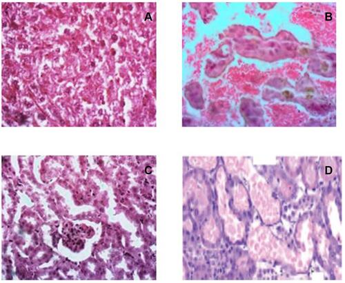 Figure 1 Photomicrographs showing: (A). Normal liver from a mice in the control group; (B). Liver from a mice with single-cell necrosis of hepatocytes after treatment with PAAC at a dose of 2000 mg/kg bwt; (C). Normal Kidney from a mice in the control group; (D). Kidney from a mice after treatment with PAAC at 2000 mg/kg bwt showing patchy tubular epithelial necrosis.