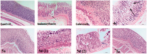 Figure 5. Haematoxylin and eosin immunohistochemical staining of gastric ulcers after ulcer induction in rats for specimen intact Mucous membrane in control, indomethacin, celecoxib-treated rat and test compounds 4c, 5a, 5d and 5e.