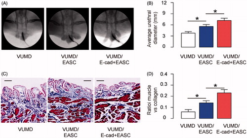 Figure 2. E-cad + EASC seeded BAMG have improved therapeutic effects during urethroplasty in rabbits. A ventral urethral mucosal defect (VUMD) was generated on rabbits and then urethroplasty was performed with either E-cad + EASC seeded BAMG or EASC (no purification for E-cad) seeded BAMG. VUMD only (no implants) was used as a control. (A,B) Retrograde urethrograms analysis, shown by representative images (A) and by quantification of the width of urethral caliber (B). (C,D) Masson-trichrome staining for the reconstructed urethral tissue, shown by representative images (C), and by quantification of the ratio of muscle versus collagen (D). *p < .05. N = 10. Scale bars are 50 µm.