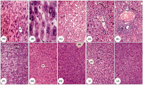Figure 3. Photomicrographs of H&E stained liver sections of control, AOM and AOM mice treated with T. ornata and P. pavonia. (A and B) Liver sections of control mice showing normal histological structure of a hepatic lobule with central vein (cv) and blood sinusoid (s) (A ×400 and B ×1000), (C–F) liver sections of AOM group revealing fatty degeneration of hepatocytes (C), dilated sinusoids, congested blood vessels (D), inflammatory cell infiltration, necrosis (E), and oval cell proliferation (F) [×x400], (G and H) liver sections of AOM + T. ornata demonstrating marked improvement of liver architecture with mild fatty degeneration in some hepatocytes [×400], and (I and J) sections of AOM + P. pavonia showing more or less normal liver section, mild fatty changes and normal well differentiated nuclei [×400].