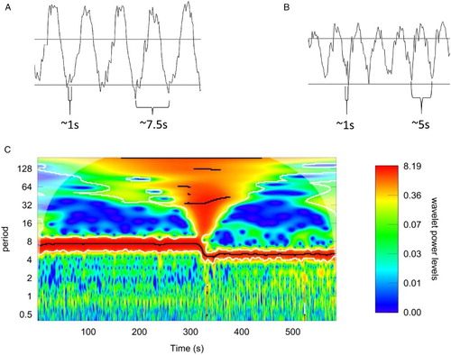 Figure 2 Agreement between oscillations in redox potential and breathing. Fragment of the oscillations for two breathing frequencies, ∼7.5 Hz (A) and 5 Hz (B). The scale is preserved – faster breathing resulted in visibly lower amplitude of oscillations. (C) The wavelet analysis of the measured signal. The change in period of the observed oscillations due to change in the breathing frequency is clearly visible. Heartbeat oscillations are seen as a wide band in the period range of 0.3–1. Slow oscillations are visible, albeit not statistically significant, in this measured window.