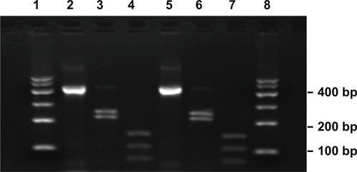 Figure 4 Restriction analyses of the isolated strain amplification products.