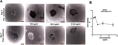 Figure 8 The effect of C. siphonella on the 3D culture of HepG-2. (A) Representative images show the spheroid shape of MCF-7 before and after being treated with C. siphonella extract at different doses 125 ug/mL, 62.5 ug/mL and 31.25 ug/mL. Scale bar 200mm. (B) Graphical presentation represents the percentage of cell viability. Data are displayed as mean ± SD.