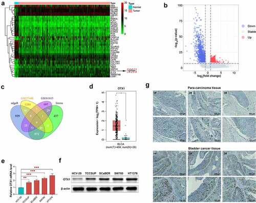 Figure 1. OTX1 was overexpressed in BC. (a). Hierarchical clustering analysis of different genes in Normal samples and Tumor samples. (b). Volcano plot. The red dots represent up-regulated differentially expressed genes (DEGs), while the blue dots represent down-regulated DEGs (based on > 2-fold changes). (c). Venn diagram showed the distribution of DEGs in different groups. (d). Comparison of OTX1 in normal and bladder cancer tissues based on RNA-seq. (e). The mRNA level of OTX1 was detected by qPCR in HCV-29, BT-B, EJ, HT-1376 and SCaBER. (**p < 0.05, ***p < 0.001 vs. HCV-29 cells) (f). The protein level of OTX1 was measured by western blotting in HCV-29, BT-B, EJ, HT-1376 and SCaBER. (g). The expression of OTX1 was measured by IHC in para-cancerous tissue and cancer tissue
