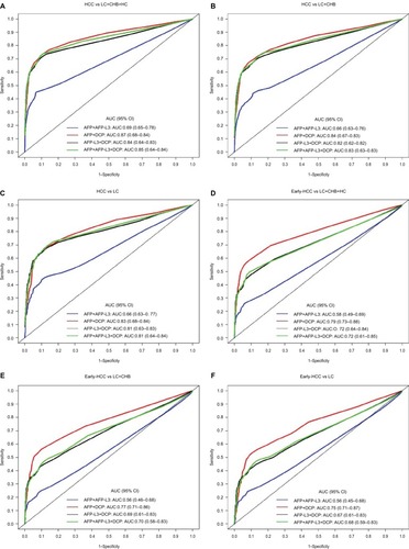 Figure 2 Comparison of .632+ adjusted receiver operating characteristics curves of four different multi-marker combinations for discriminating: (A) HCC vs CHB+LC+HC; (B) HCC vs CHB+LC; (C) HCC vs CHB; (D) early-stage HCC vs CHB+LC+HC; (E) early-stage HCC vs CHB+LC; and (F) early-stage HCC vs LC.Abbreviations: AFP, alpha-fetoprotein; AFP-L3, lens culinaris agglutinin-reactive AFP; AUC, area under the curve; CENPF, centromere protein F autoantibody; CHB, chronic hepatitis B virus infection; DCP, des-gamma-carboxyprothrombin; HC, healthy control; HCC, hepatocellular carcinoma; LC, liver cirrhosis; SCCA, squamous cell carcinoma antigen.