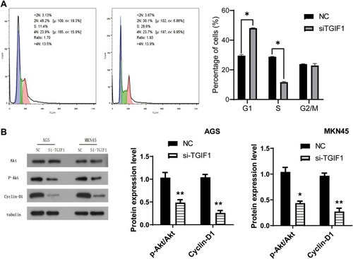 Figure 4 TGIF1 affected the AKT signaling pathway in gastric cancer cells.